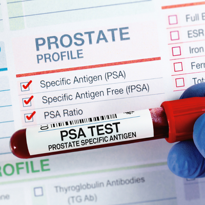 prostate screening test tube