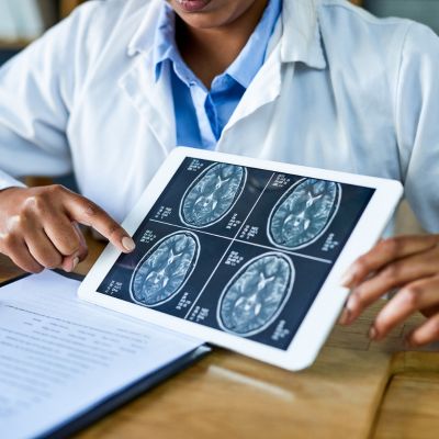 A neurosurgeon pointing at a scan of a brain