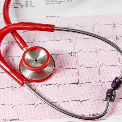 A stethoscope laying on top of EKG graphs