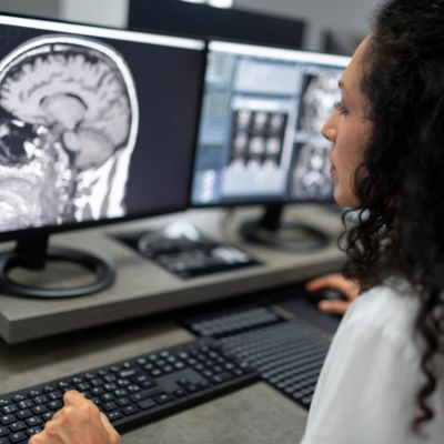 Doctor looking at brain scans