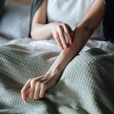 person scratching their arm that is red