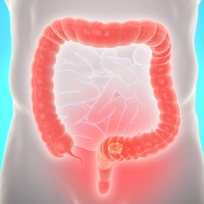 graphic of a colon
