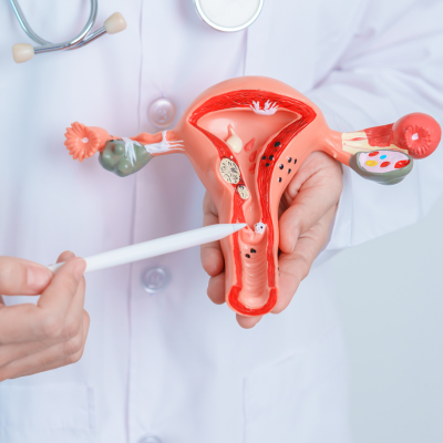 Fibroids Podcast