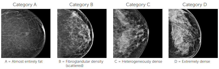 Breast Density Categories