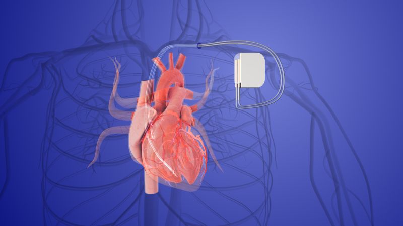 Image of heart