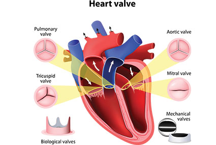 Heart Valve