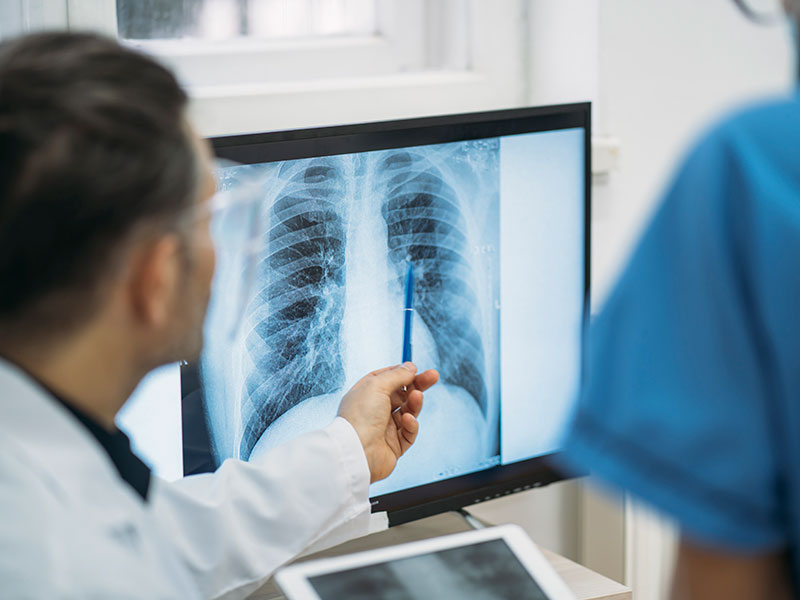 heart x-ray