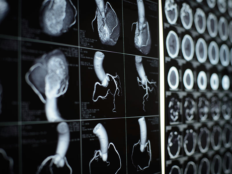 heart images
