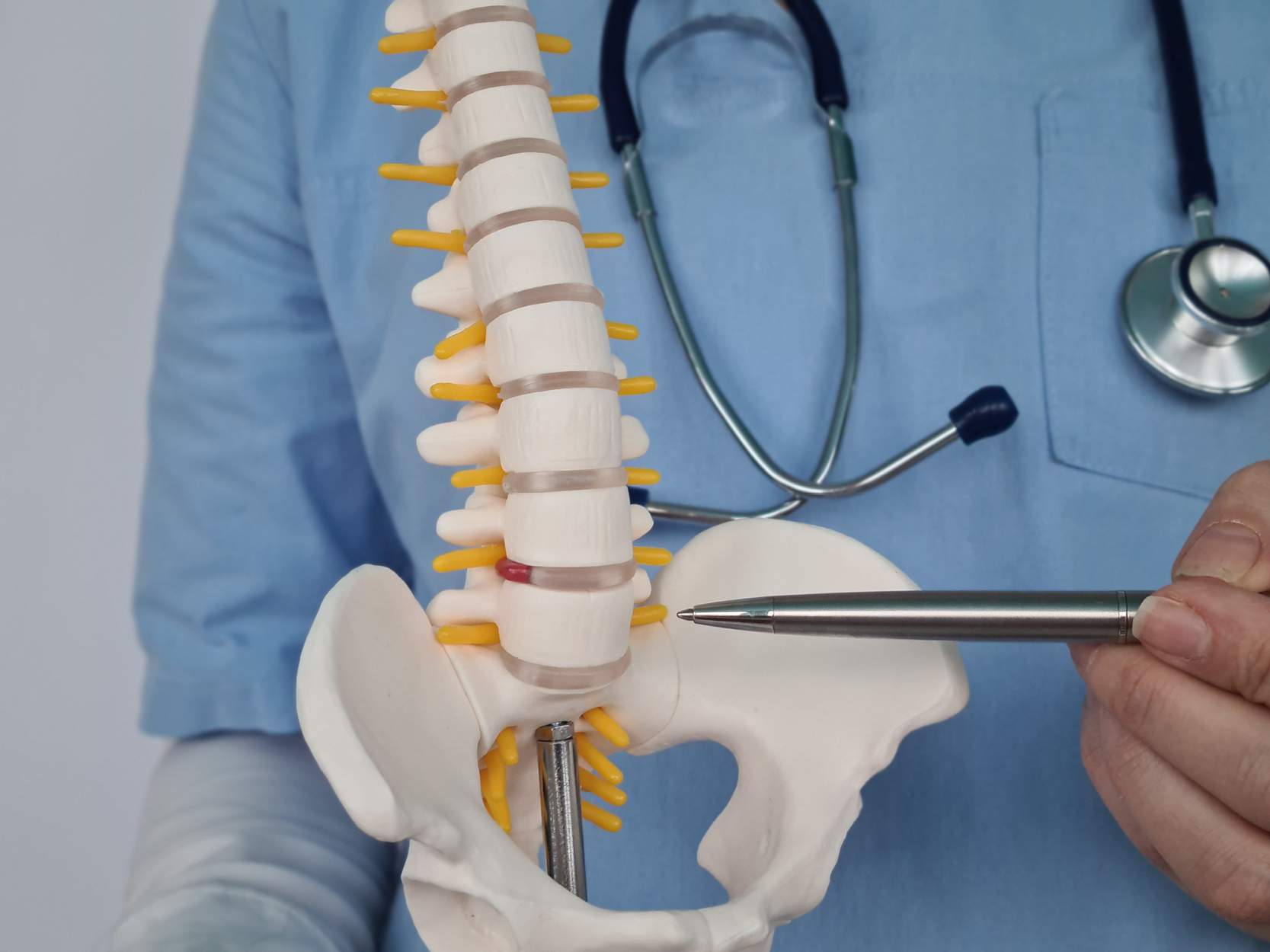 Doctor shows inflammation and pain in intervertebral discs hernia of displaced joints
