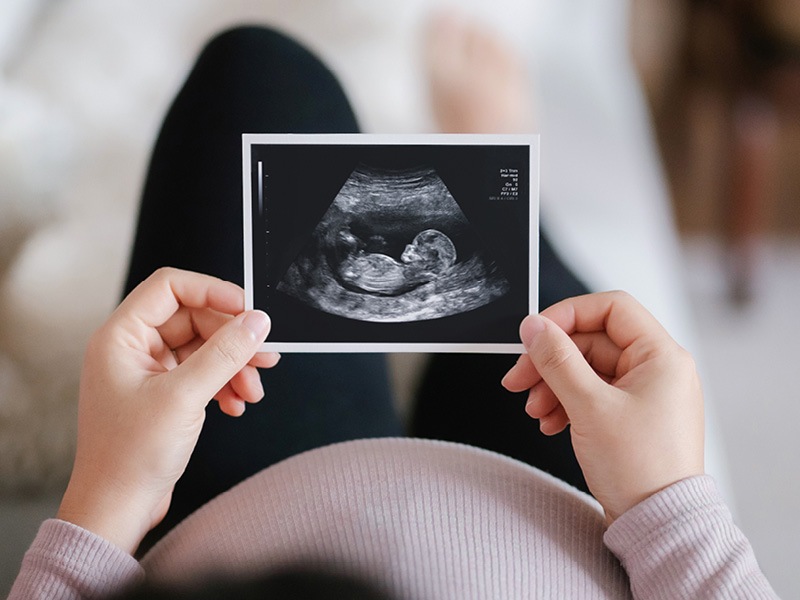 Preparing for Baby